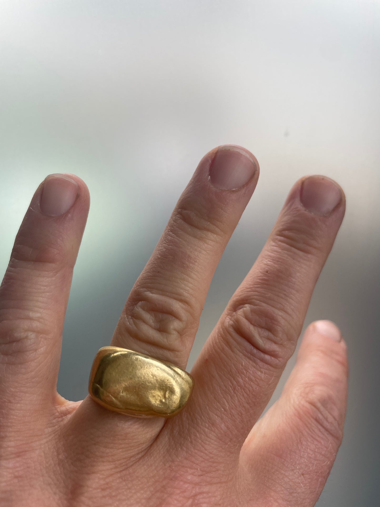 Vitmin D ring